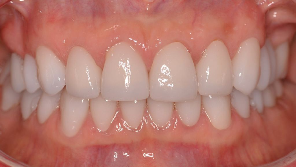dentistra_prije_poslije_1a