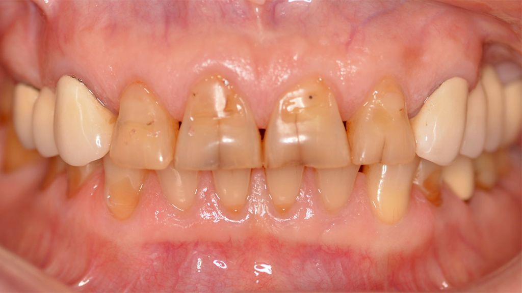 dentistra_prije_poslije_1b