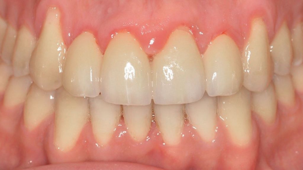 dentistra_prije_poslije_2a1