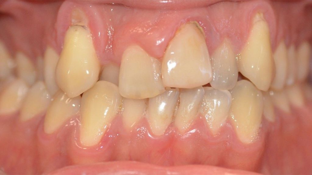 dentistra_prije_poslije_2b