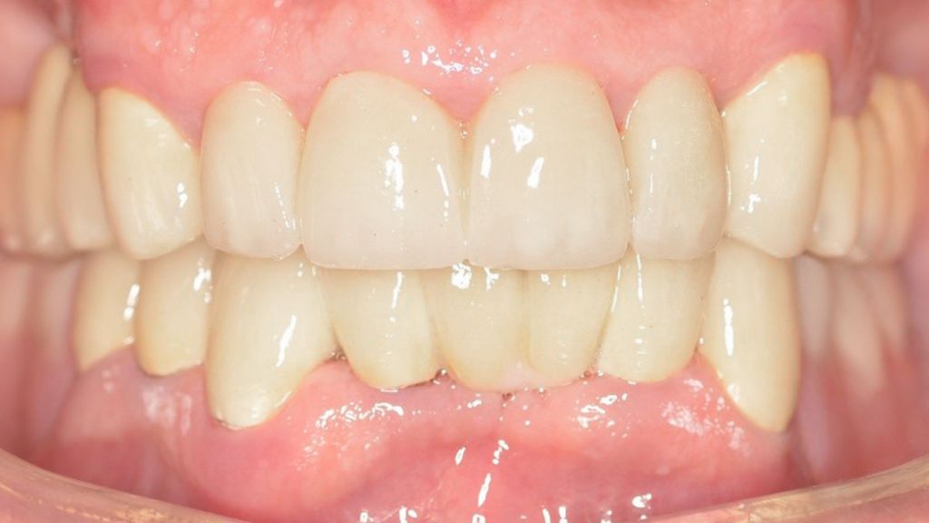 dentistra_prije_poslije_3a1