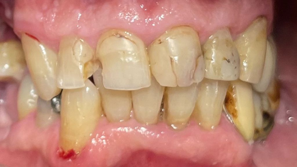 dentistra_prije_poslije_3b
