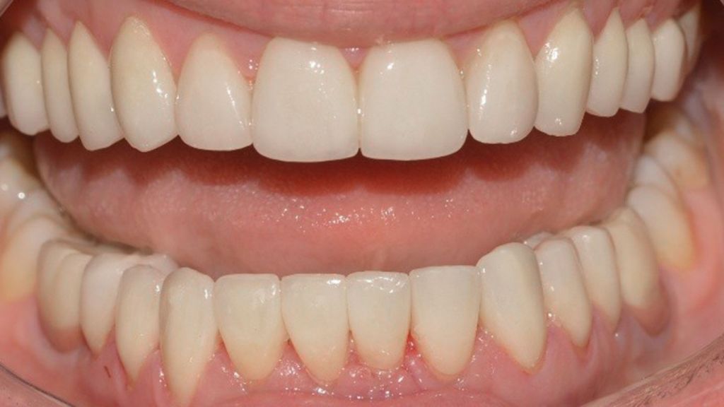 dentistra_prije_poslije_4a