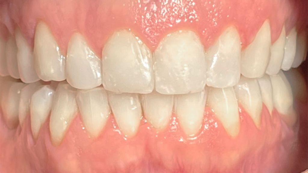 dentistra_prije_poslije_4b