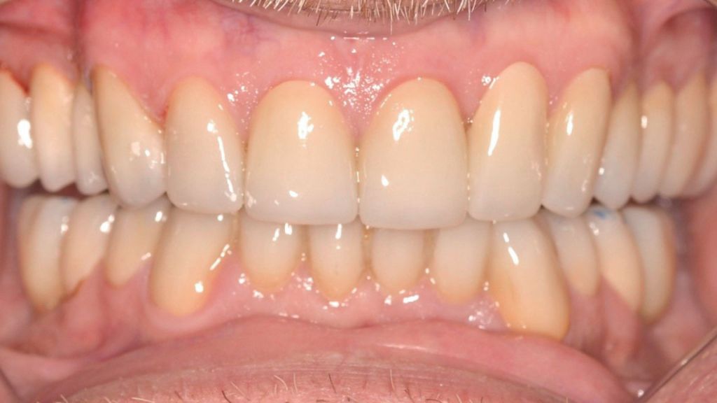dentistra_prije_poslije_5a