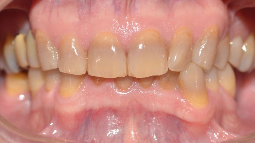 dentistra_prije_poslije_5b